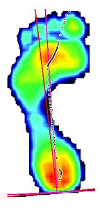 rsscan footscan stopa